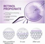 خرید Retinol Eye Under Eye Cream with Cooling Roller, از آمازون امارات