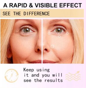 خرید Eye Cream, Anti Wrinkle Eye Cream, Eye Repair از آمازون امارات