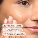 خرید The Ordinary Aloe 2% + NAG 2% Solution از آمازون امارات