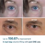خرید Dr.Melaxin Eyephalt Eyebag Cream for Puffiness, Dark Circles از آمازون امارات