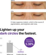 خرید Some By Mi Retinol Intense Advanced Triple Action از آمازون امارات