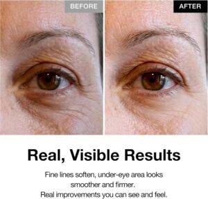خرید Retinol 0.1% Eye Cream with Bakuchiol 0.5% | از آمازون امارات