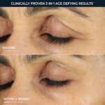 خرید RoC Retinol Correxion Anti-Aging Eye Cream Treatment for از آمازون امارات